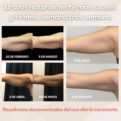 Formujer 3D Mangas Moldeadoras – Adiós a los brazos flácidos